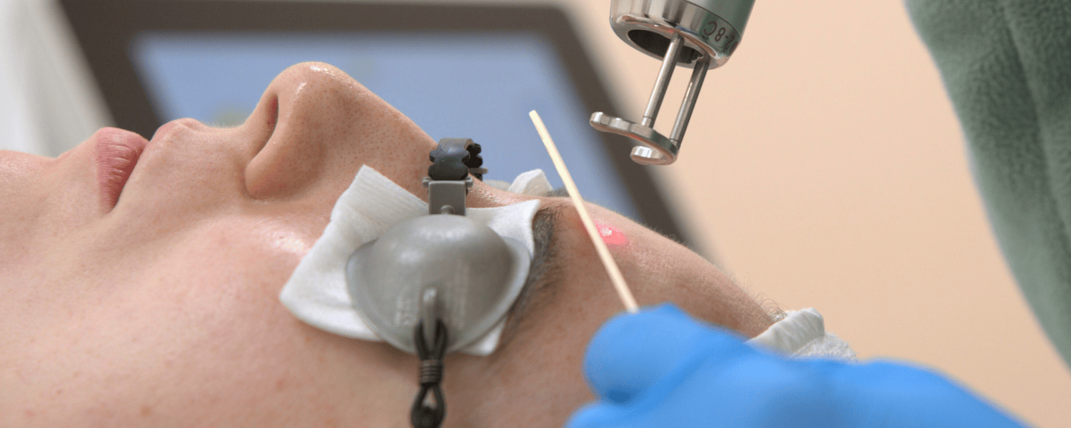 Laser skin resurfacing and rejuvenation treatment in Abu Dhabi