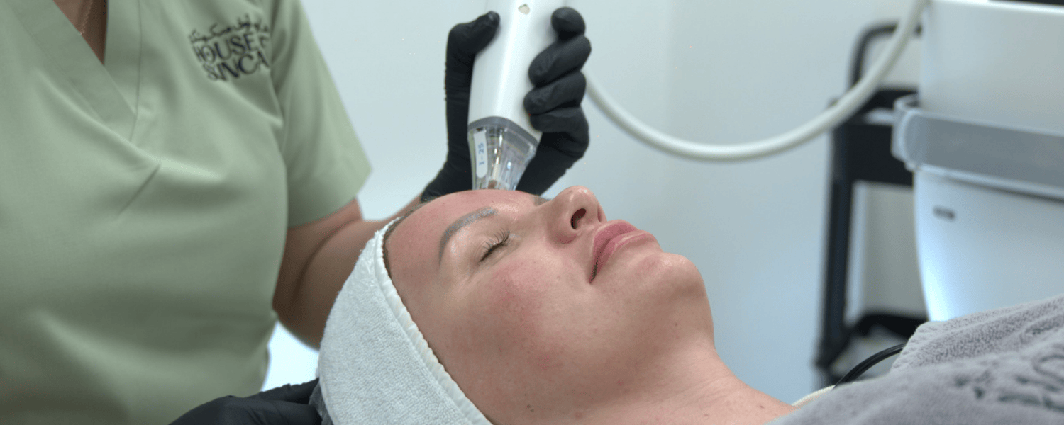 Potenza RF microneedling treatment for skin tightening and collagen stimulation in Abu Dhabi